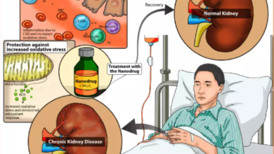 Rare Kidney Disease