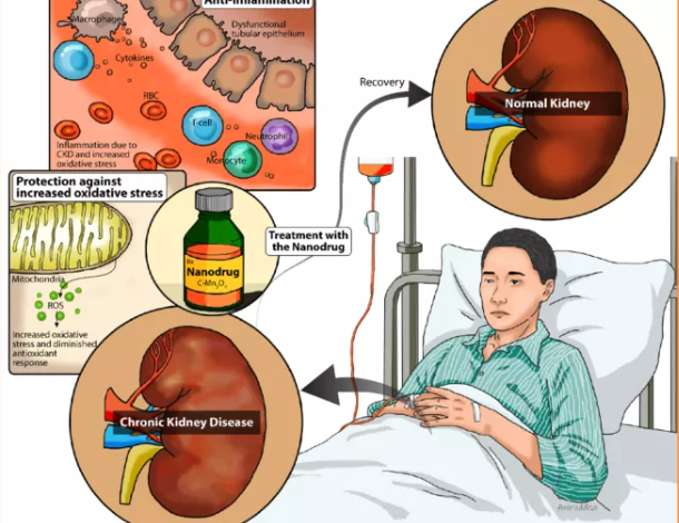 Rare Kidney Disease